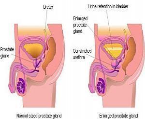 導(dǎo)致性交疼痛的病因